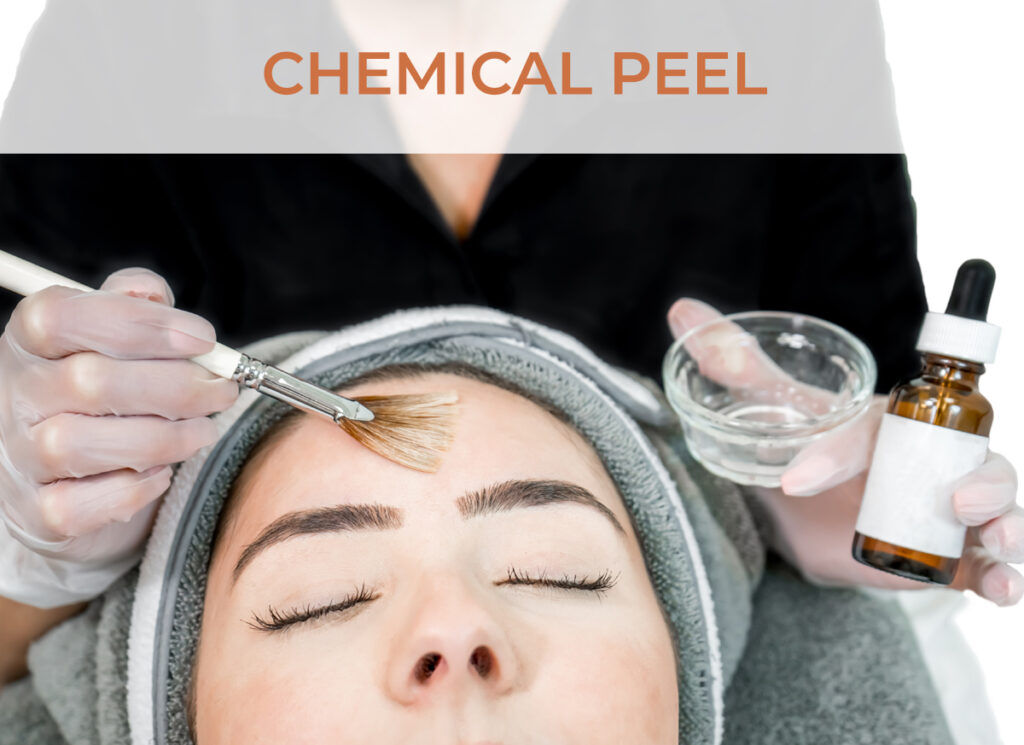 Chemical Peel - Click to shop our online store