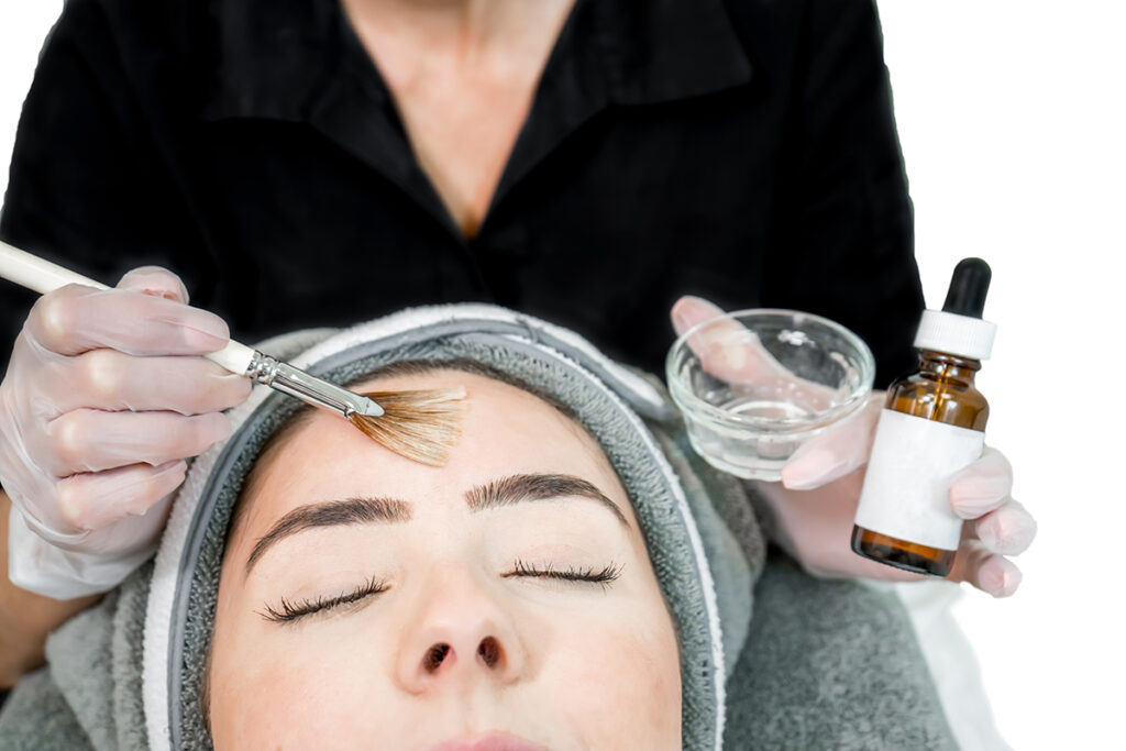 Chemical Peel Service - Photo of Woman getting application done to her forehead