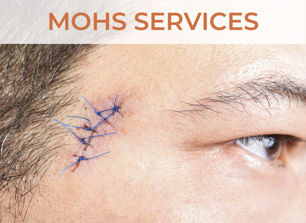 Mohs Services - Click to learn more