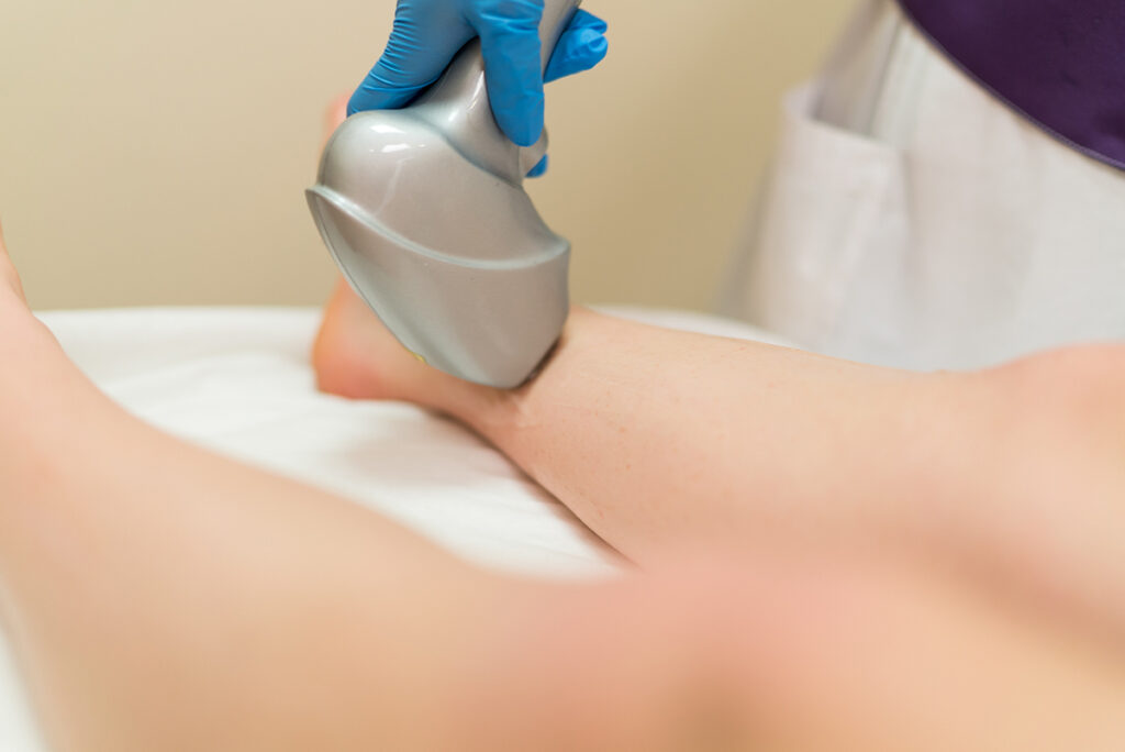 Laser Rejuvenation - Woman getting procedure on her leg