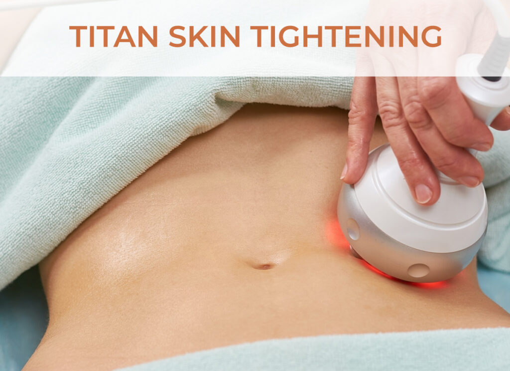 Titan Skin Tightening Service - Click to learn more